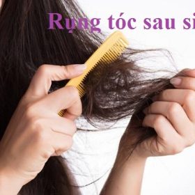 Nguyên nhân rụng tóc sau sinh và cách phục hồi