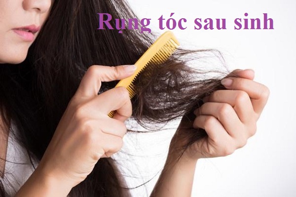Nguyên nhân rụng tóc sau sinh và cách khắc phục